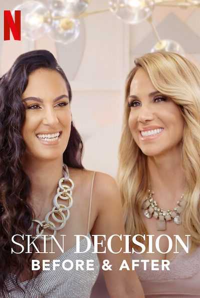 برنامج Skin Decision: Before and After الموسم الاول